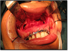 Oral & Maxillofacial Surgery